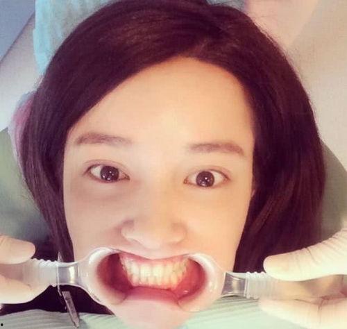 娱乐圈吃瓜张大奕,揭秘张大奕的明星生活与争议风波